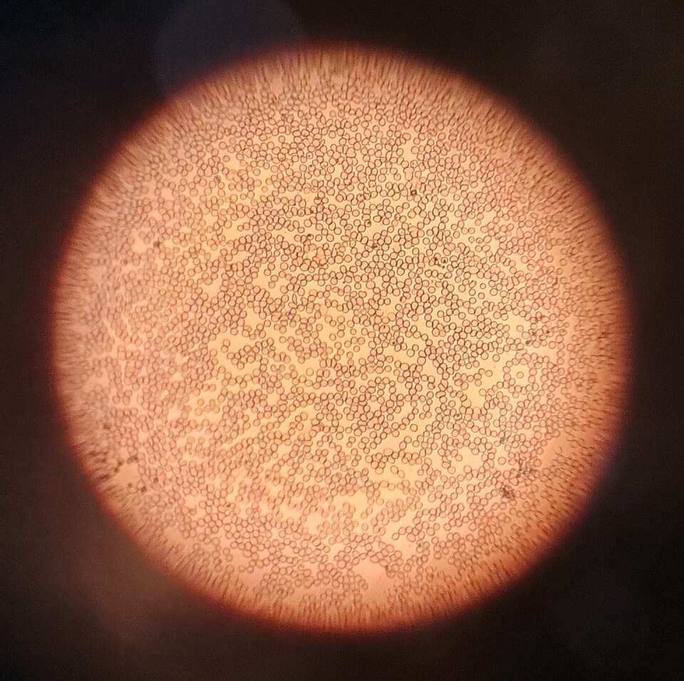 Red blood cells under a microscope